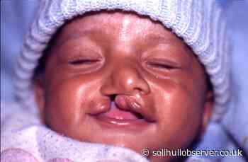 Solihull Spire Parkway surgeon to start new role researching cleft palates and cleft lips - Solihull Observer