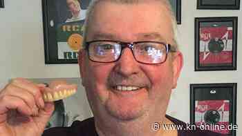 Betrunkener britischer Tourist verliert in Spanien seine Zähne - elf Jahre später bekommt er sie zurück