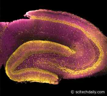 In the Process of Solving a Decades-Long Mystery, Scientists Discover Where Schizophrenia May Originate in the Brain