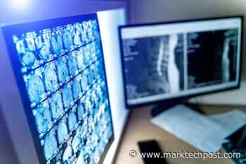 UT Austin Researchers Demonstrate a Deep Learning Technique That Achieves High-Quality Image Reconstructions Based on MRI Datasets - MarkTechPost