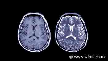 The Quest to Make a Digital Replica of Your Brain