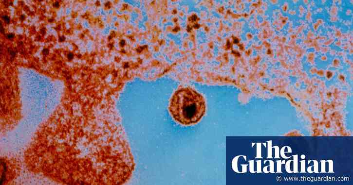 Third person apparently cured of HIV using novel stem cell transplant