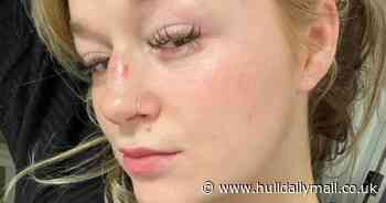 Mum attacked outside Beverley takeaway as onlooker filmed terrifying ordeal - Hull Live