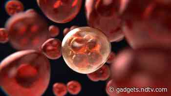 First Woman Said to Be Cured of HIV After Stem Cell Transplant