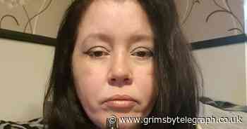 Woman's warning after vape pen catches fire in her mouth - Grimsby Live