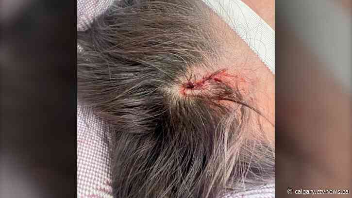 Calgary shopper suffers head wounds when fitting room mirror topples