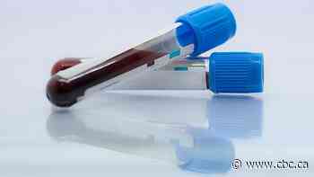 Doctors asked to delay non-urgent blood tests as Alberta faces shortage of collection vials