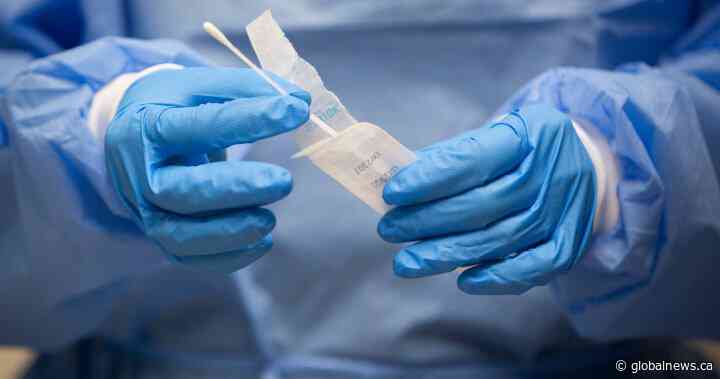 COVID-19: Saskatchewan reports 2,522 cases last week, 410 in hospital Wednesday - Global News