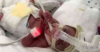 Bonn: Frühchen Emil kam mit 390 Gramm zur Welt - General-Anzeiger Bonn