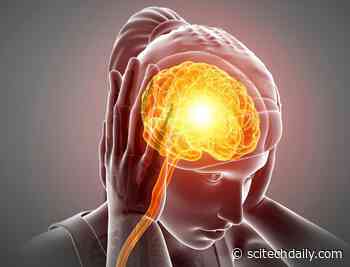 Groundbreaking Genome Study of Migraine Reveals New Genetic Risk Factors