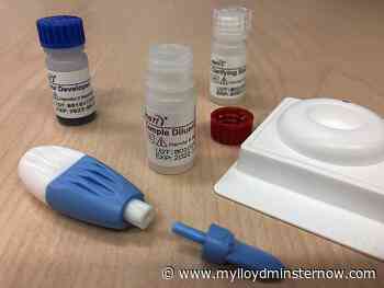 Free HIV self-test kits available in Saskatchewan - My Lloydminster Now