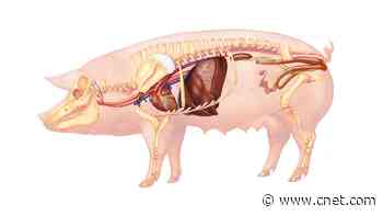 How Doctors Gave a Man a Genetically Modified Pig Heart video     - CNET