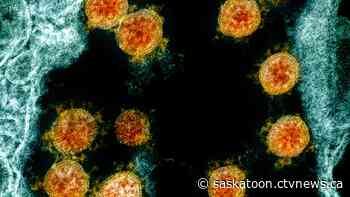 Saskatoon sees rise in coronavirus RNA levels in wastewater - CTV News Saskatoon