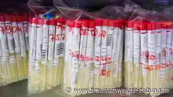 PCR-Tests: Was sagt der CT-Wert bei Corona-Tests aus?