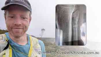 Ultra-runner Chris Jones runs Overland Track with fractured fibula - Gloucester Advocate