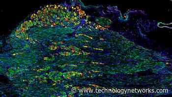The Neural Architecture Behind Swallowing Disorders in Children - Technology Networks