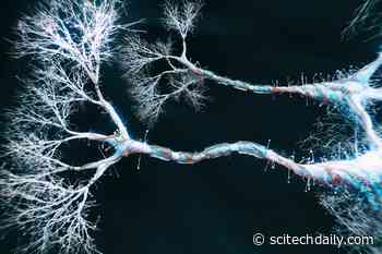 Branch-Like Projections Called Dendrites May Help Neurons Perform Complicated Calculations