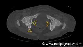 Targeted Combo Impresses in Resistant Myelofibrosis