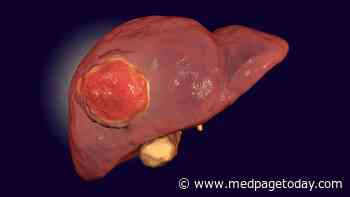 AGA: Consider Individualized Approach for Systemic Therapy in HCC