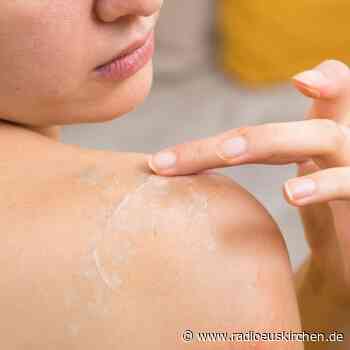 Hautflecken: Kleienpilzflechte muss meist behandelt werden - radioeuskirchen.de
