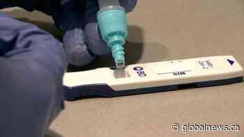 Saskatchewan reports 1,407 COVID-19 cases, 372 in hospital Wednesday - Globalnews.ca