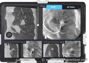 Camden Clark Medical Center using intraoperative CT imaging for lung cancer diagnosis - Parkersburg News