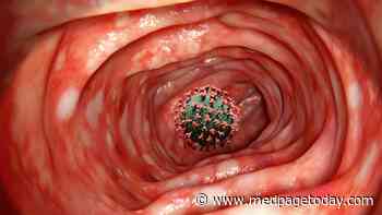 Ulcerative Colitis With an Unexpected Cause