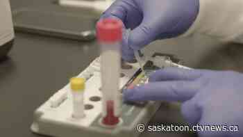 Sask. COVID-19 policy makes its residents 'almost like guinea pigs'