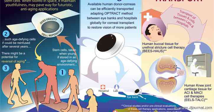 La méthode OPTRACT : Un transport efficace de cornée prélevée sur donneurs humains et le dépôt futuriste de cellules en apesanteur pour la rechercge anti-vieillissement de l'âge de l'aérospatiale ; la 