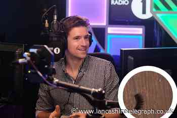 Burnley: Greg James finds nail and false eyelash in hotel