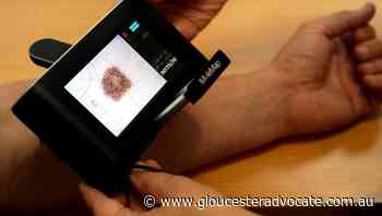 Aussie research aiming to starve melanomas - Gloucester Advocate