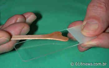 BIRIGUI FARÁ CAMPANHA PARA COLETA GRATUITA DE PREVENTIVOS - 018news