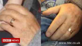 Basildon Hospital patient's wedding ring stolen - BBC