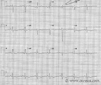 Cureus | Intracardiac Thrombus in Coronavirus Disease-2019 - Cureus