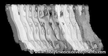 Generative design software - Today's Medical Developments