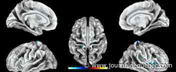 L’alcool ferait fondre la taille du cerveau