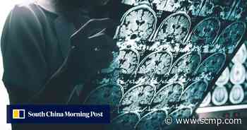 Even mild Covid-19 cases may change the brain, Oxford study finds - South China Morning Post