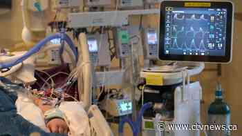 Scientists identify new gene differences in severe COVID-19 patients - CTV News