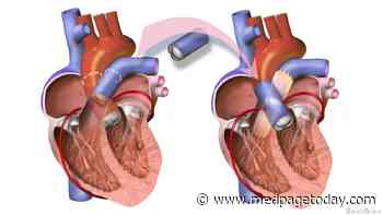 Ross Procedure Best for Fixing Aortic Valve in Younger Patients?