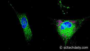 A Protein That Is Too Effective: The Role of Lipids in the Development of Alzheimer’s Disease
