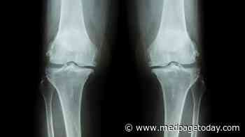 Hopes Dashed for Novel Osteoarthritis Treatment