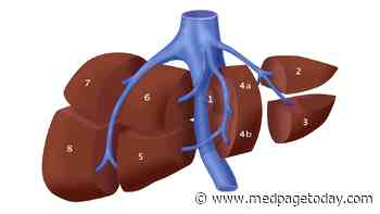 HCC Recurrence More Common in Men After Curative Surgery