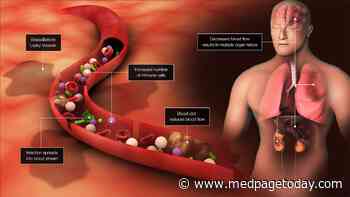 CMS Sepsis Measurement Under Fire