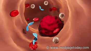 Is ctDNA Useful for Surveillance in Resected CRC?