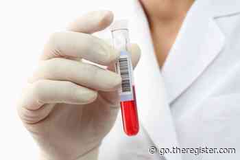 Risk-based algorithm could improve cancer screenings