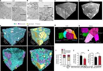 Regulation of liver subcellular architecture controls metabolic homeostasis - Nature.com