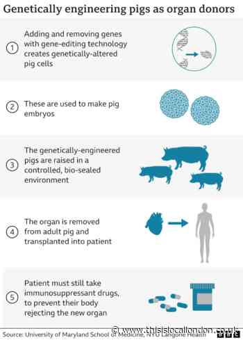 The dangers of xenotransplantation by Ally Leaver from Surbiton High