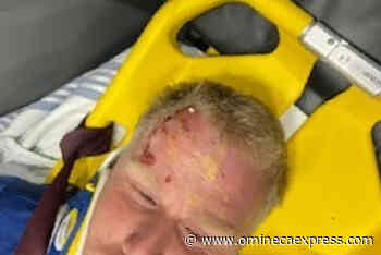 Vancouver Island man knocked unconscious by egg thrown from car – Vanderhoof Omineca Express - Omineca Express