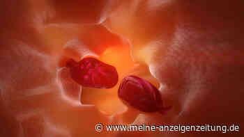 Darmkrebs vorbeugen: Auf diese Symptome sollten Sie achten