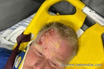 Vancouver Island man knocked unconscious by egg thrown from car – Nelson Star - Nelson Star